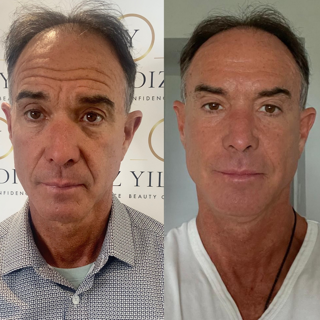 COMPLETE ANTI-AGEING PACKAGE