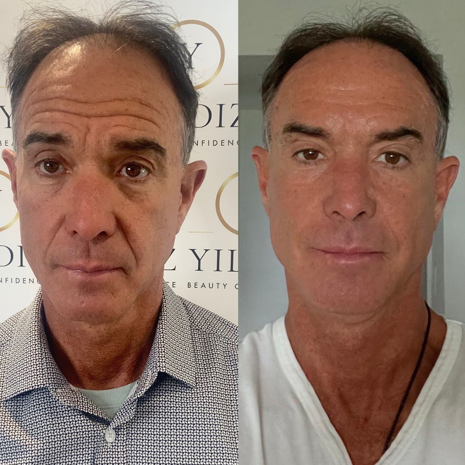 COMPLETE ANTI-AGEING PACKAGE