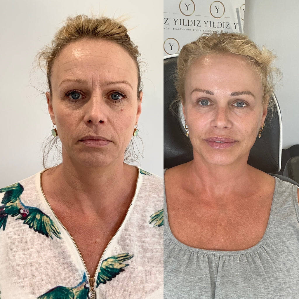 COMPLETE ANTI-AGEING PACKAGE