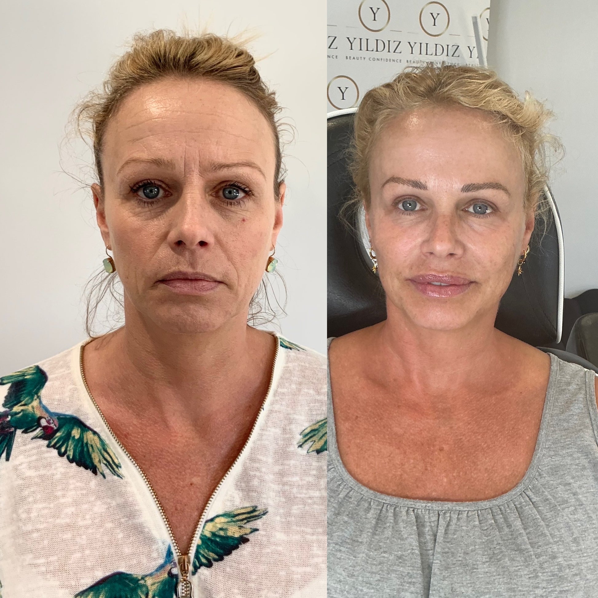 COMPLETE ANTI-AGEING PACKAGE