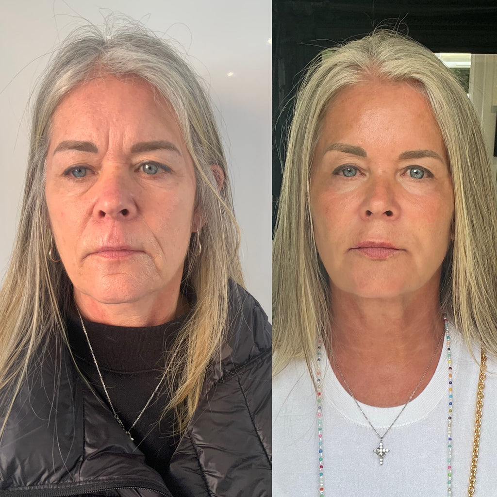 COMPLETE ANTI-AGEING PACKAGE