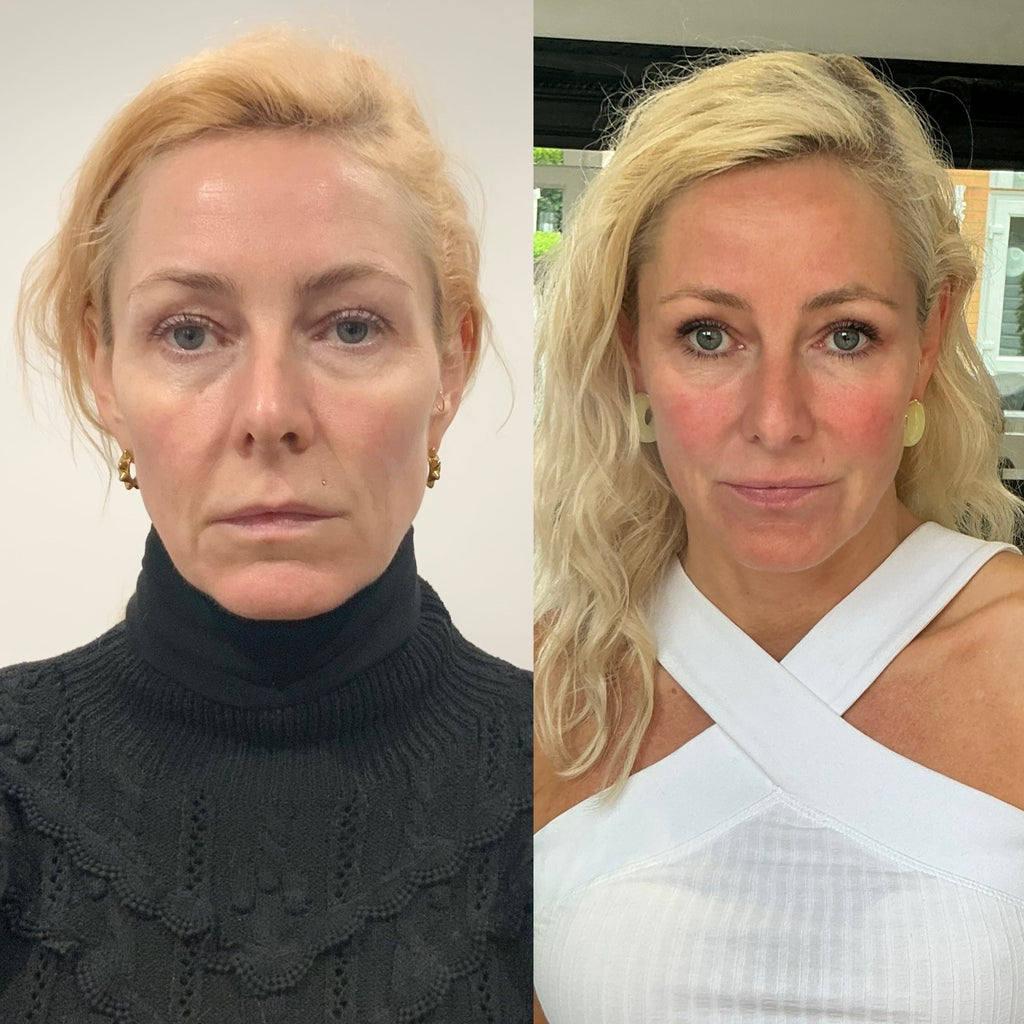 COMPLETE GLOWVERHAUL