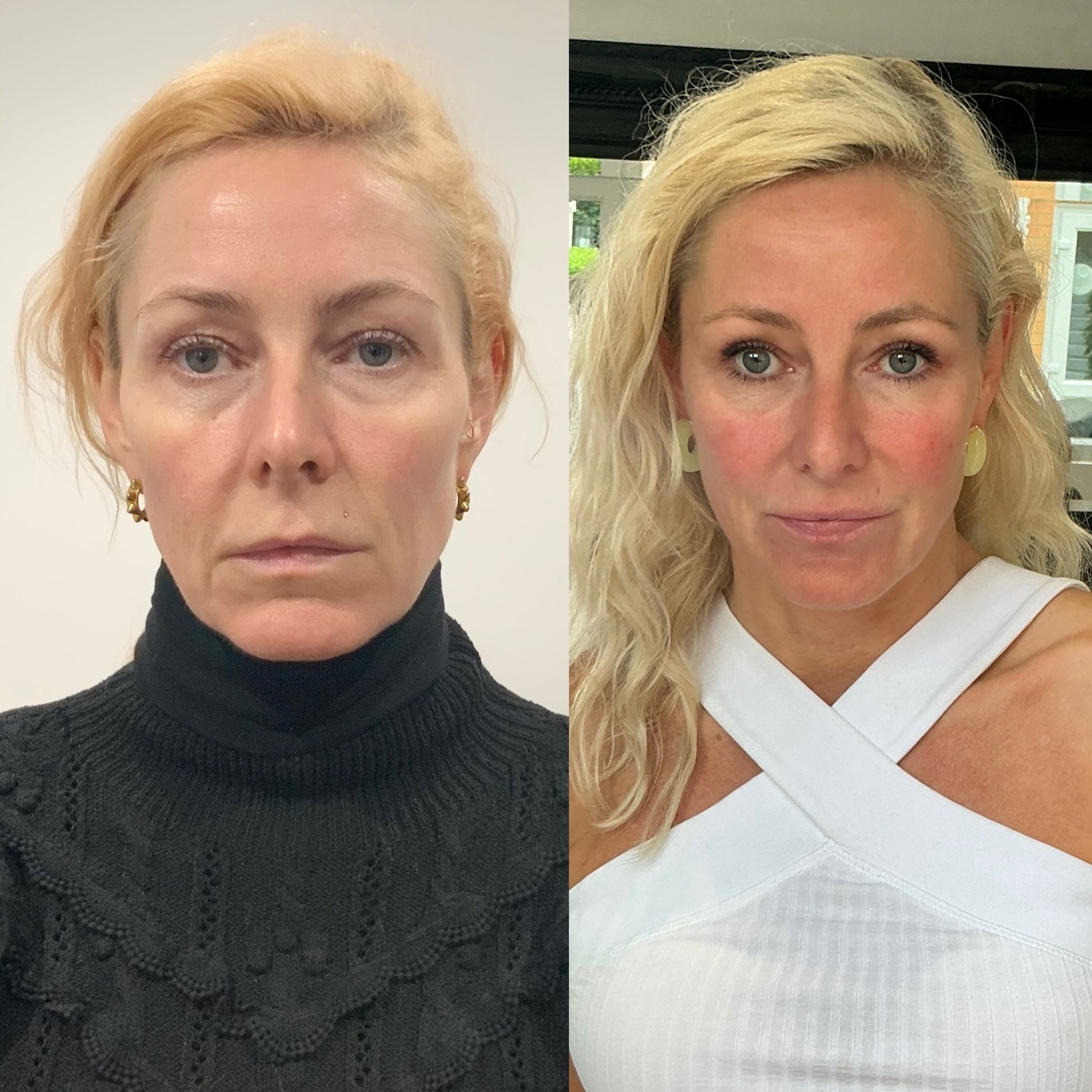 COMPLETE GLOWVERHAUL