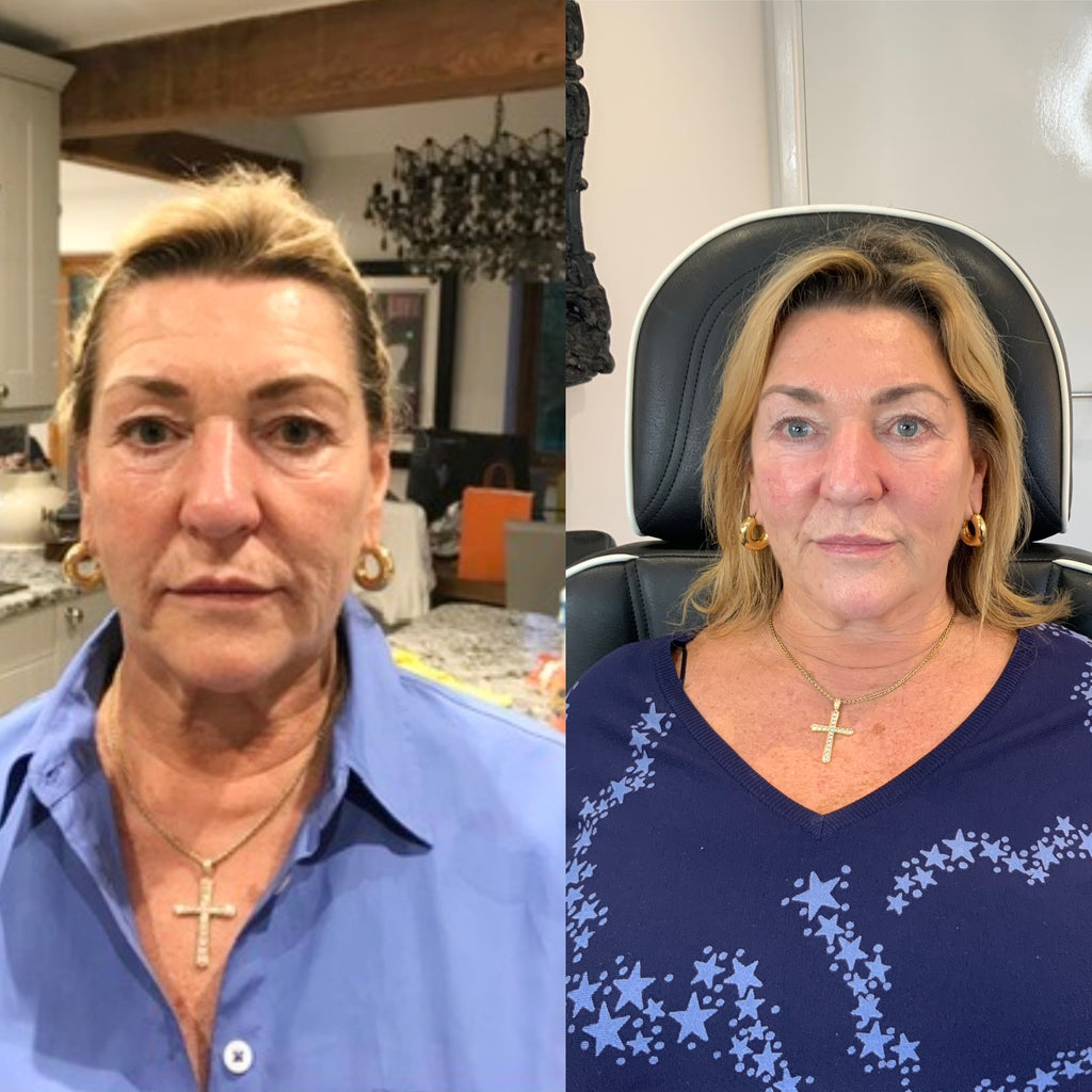 COMPLETE ANTI-AGEING PACKAGE