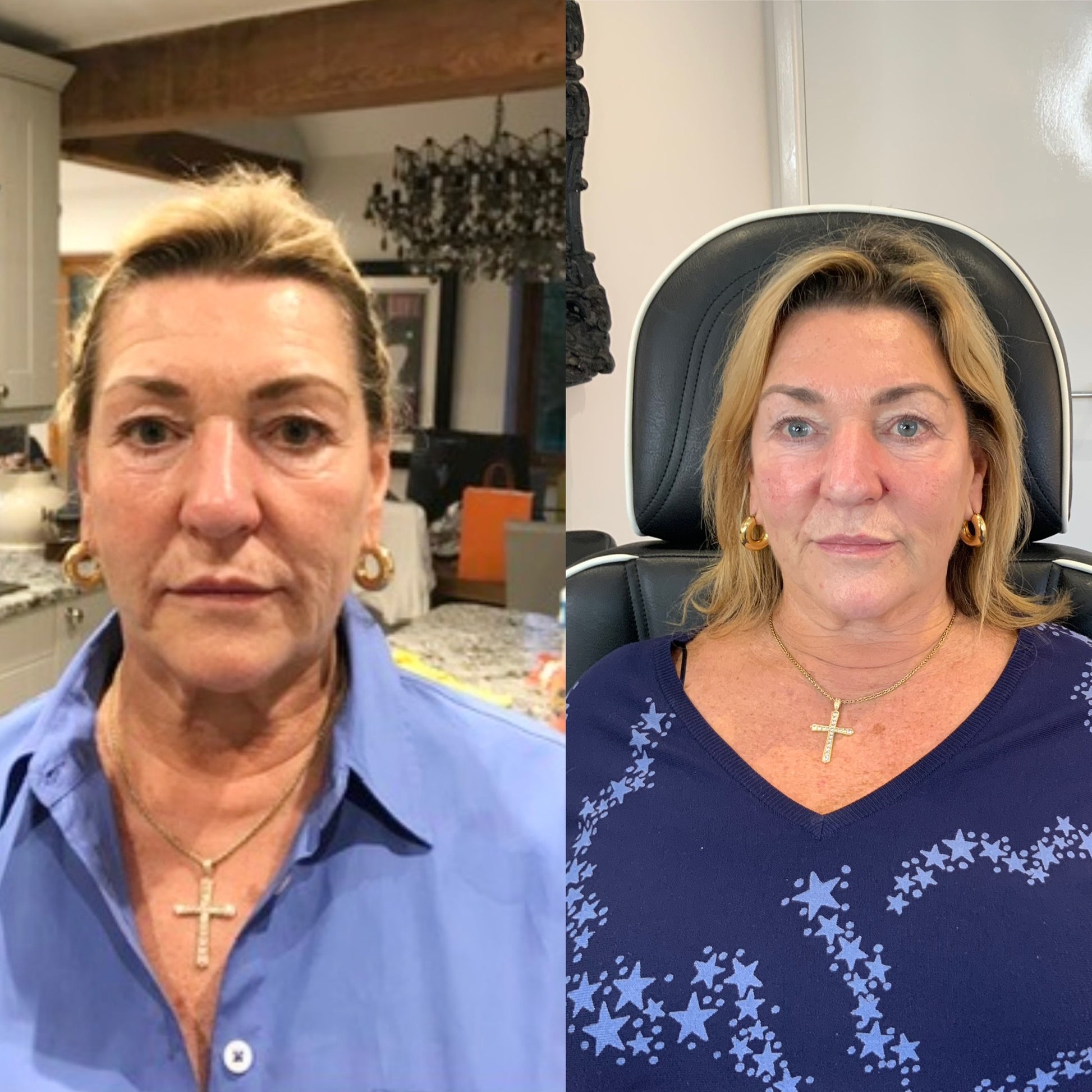 COMPLETE ANTI-AGEING PACKAGE