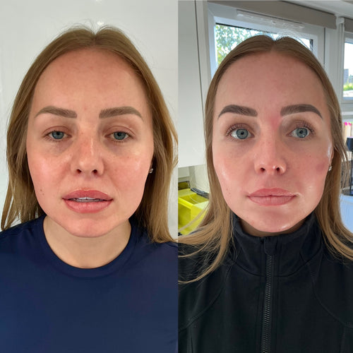 COMPLETE GLOWVERHAUL