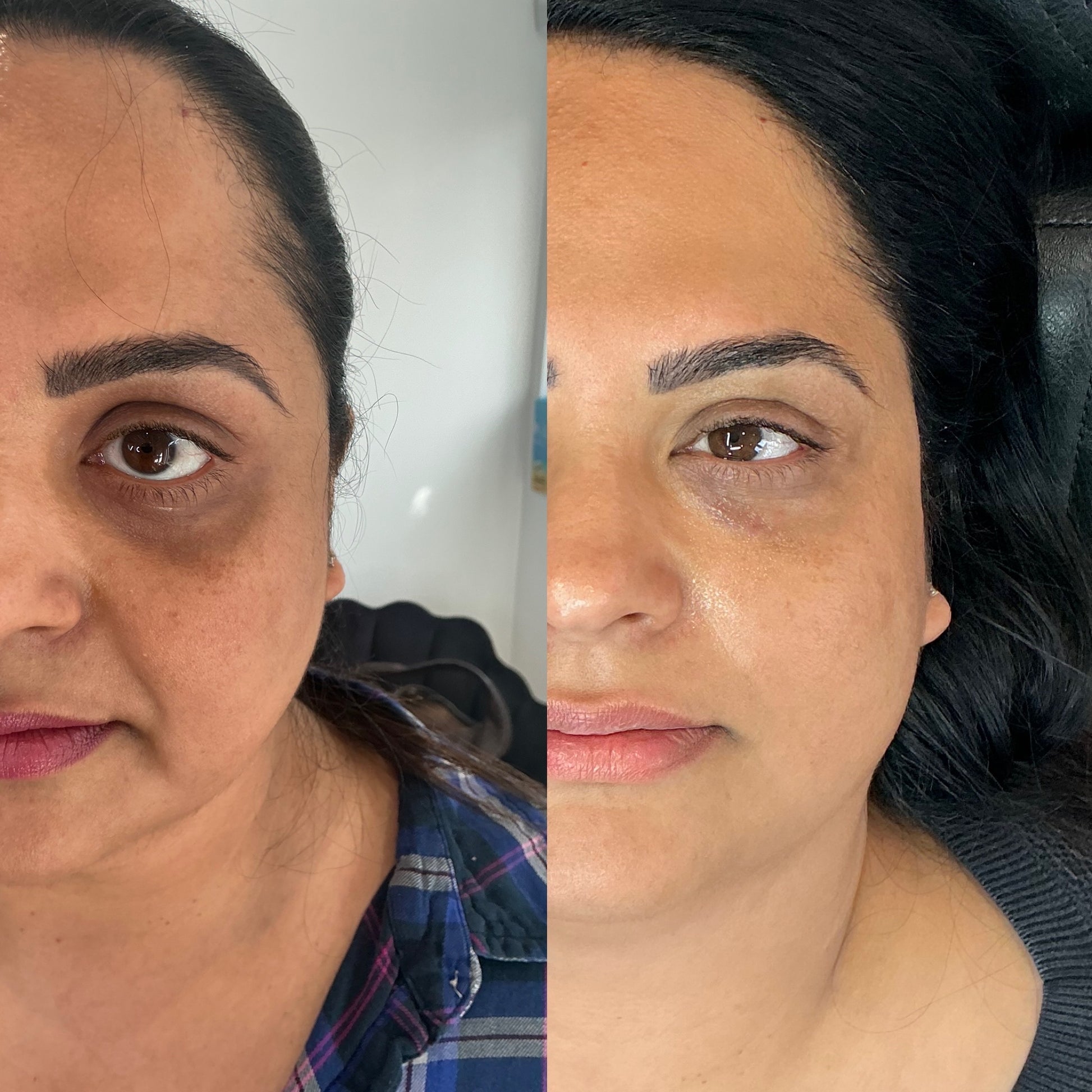 COMPLETE GLOWVERHAUL