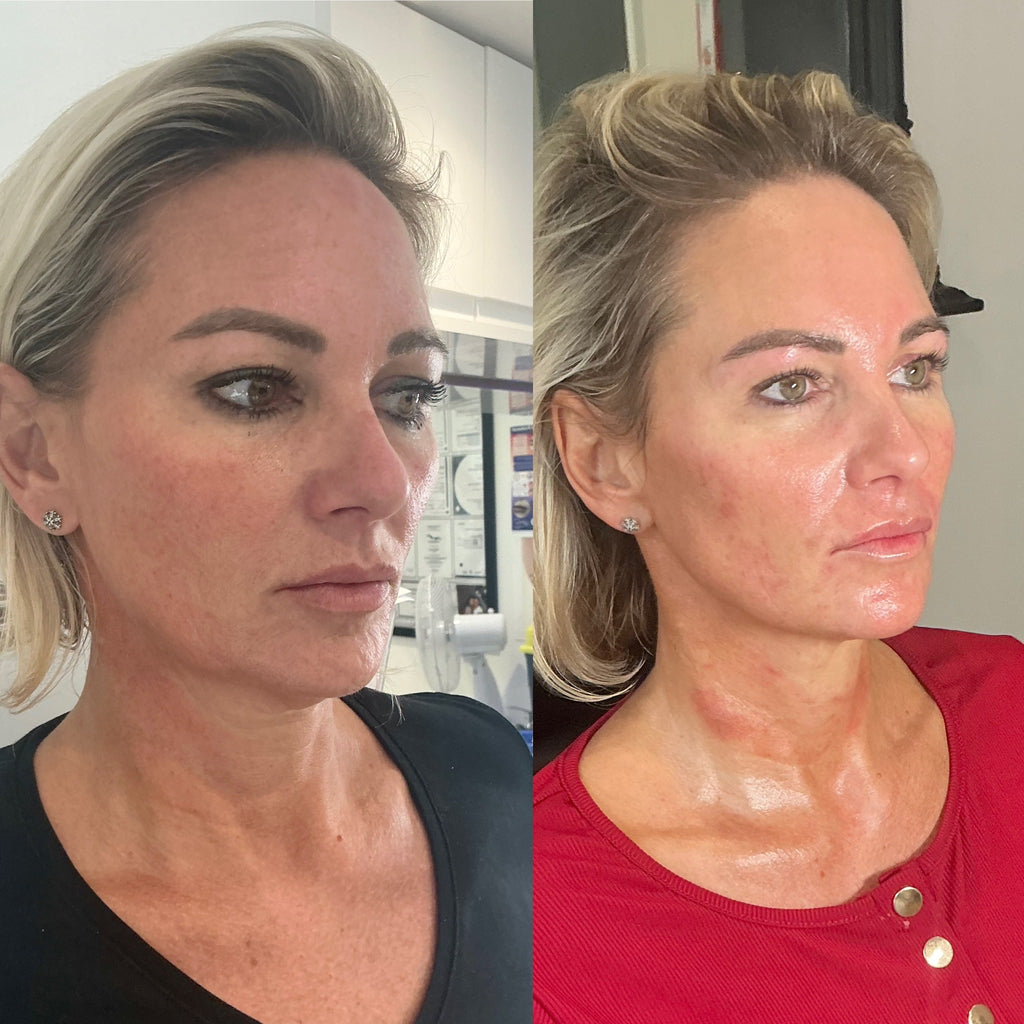 COMPLETE ANTI-AGEING PACKAGE