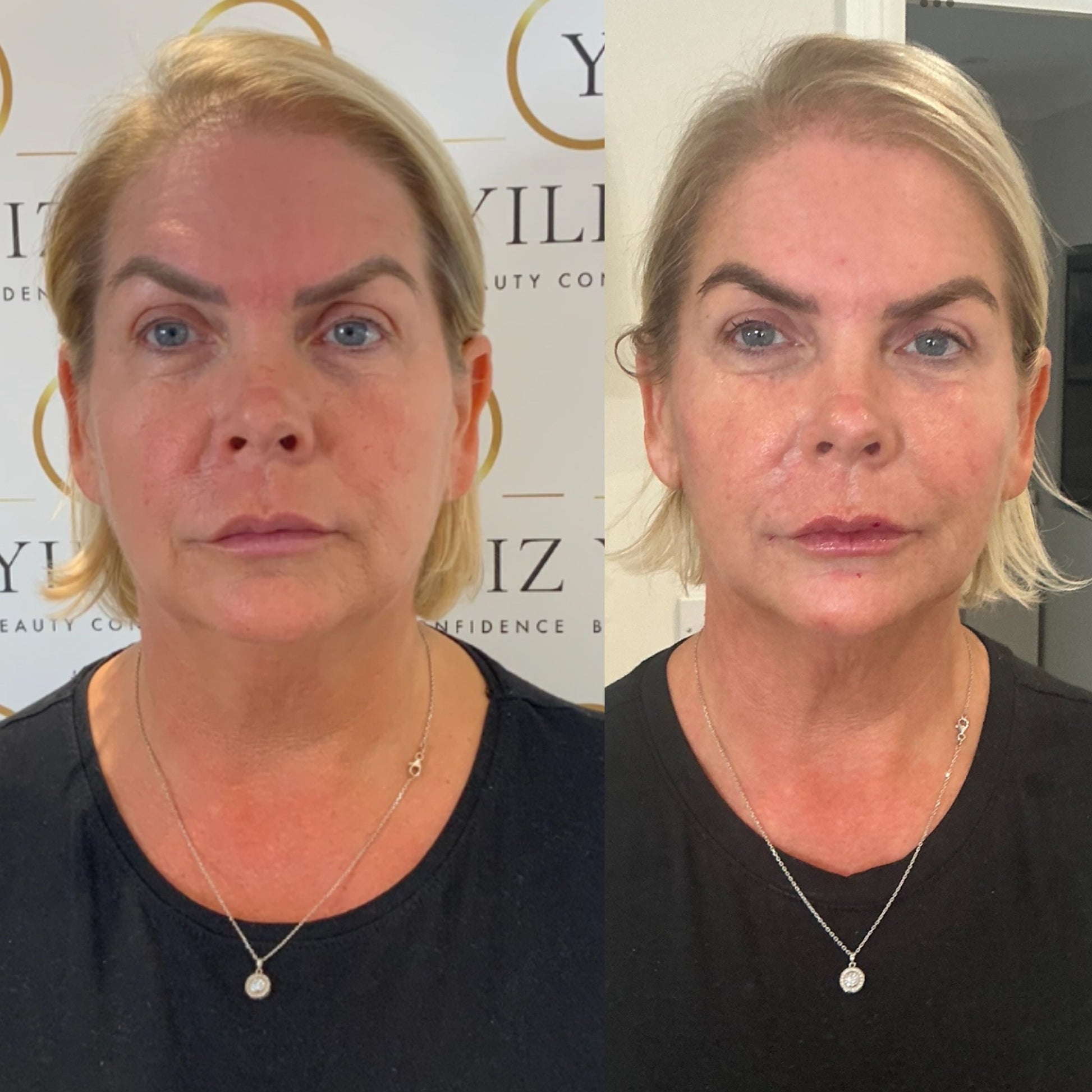 COMPLETE ANTI-AGEING PACKAGE