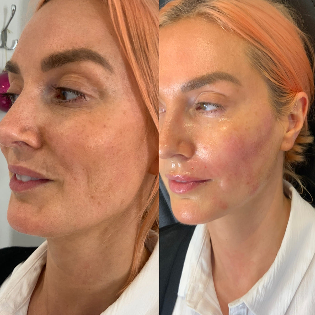 COMPLETE GLOWVERHAUL