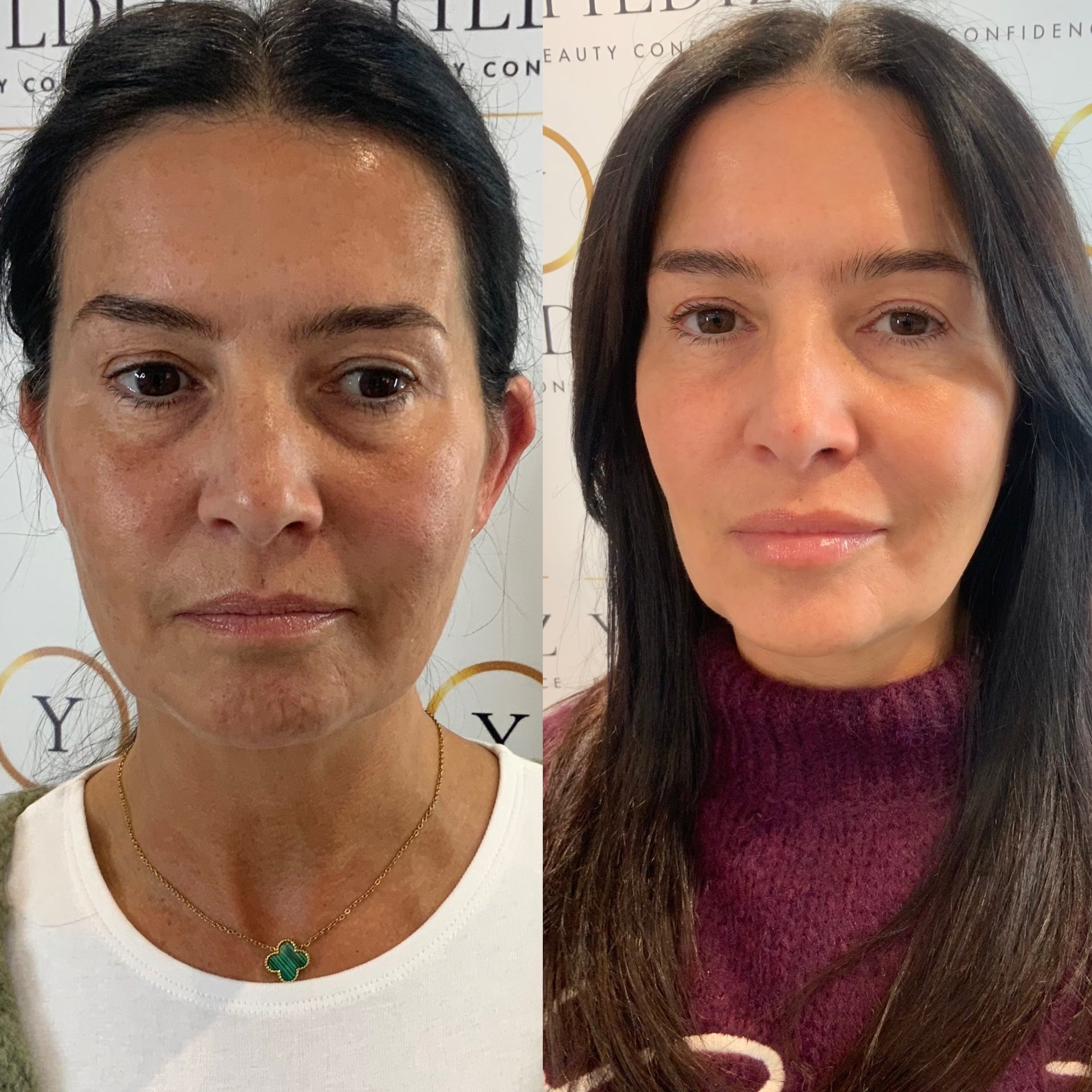 COMPLETE GLOWVERHAUL