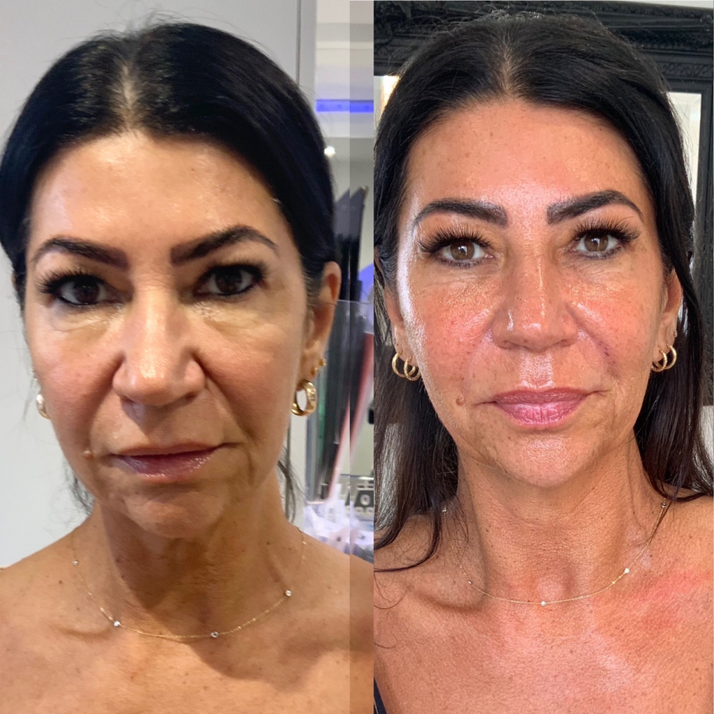 COMPLETE ANTI-AGEING PACKAGE