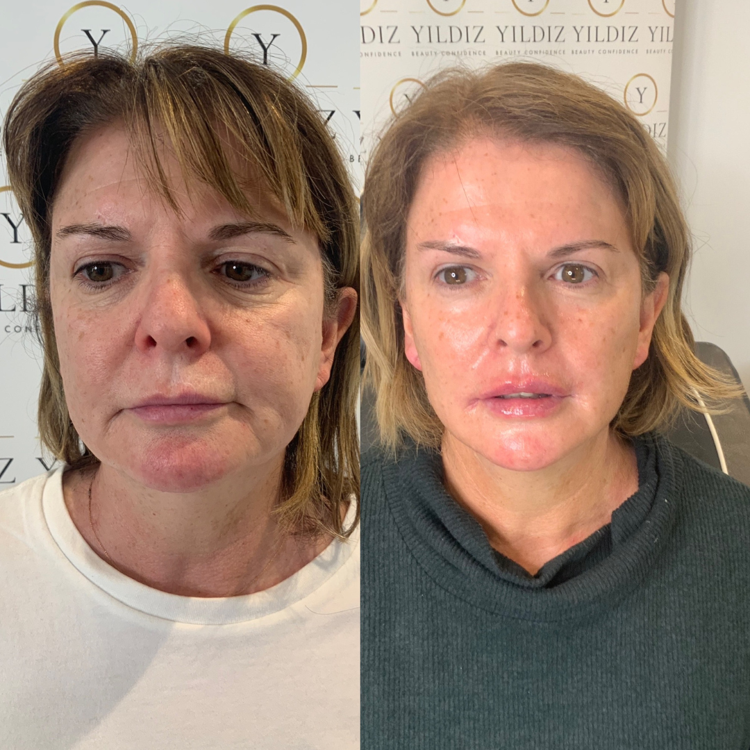 COMPLETE ANTI-AGEING PACKAGE