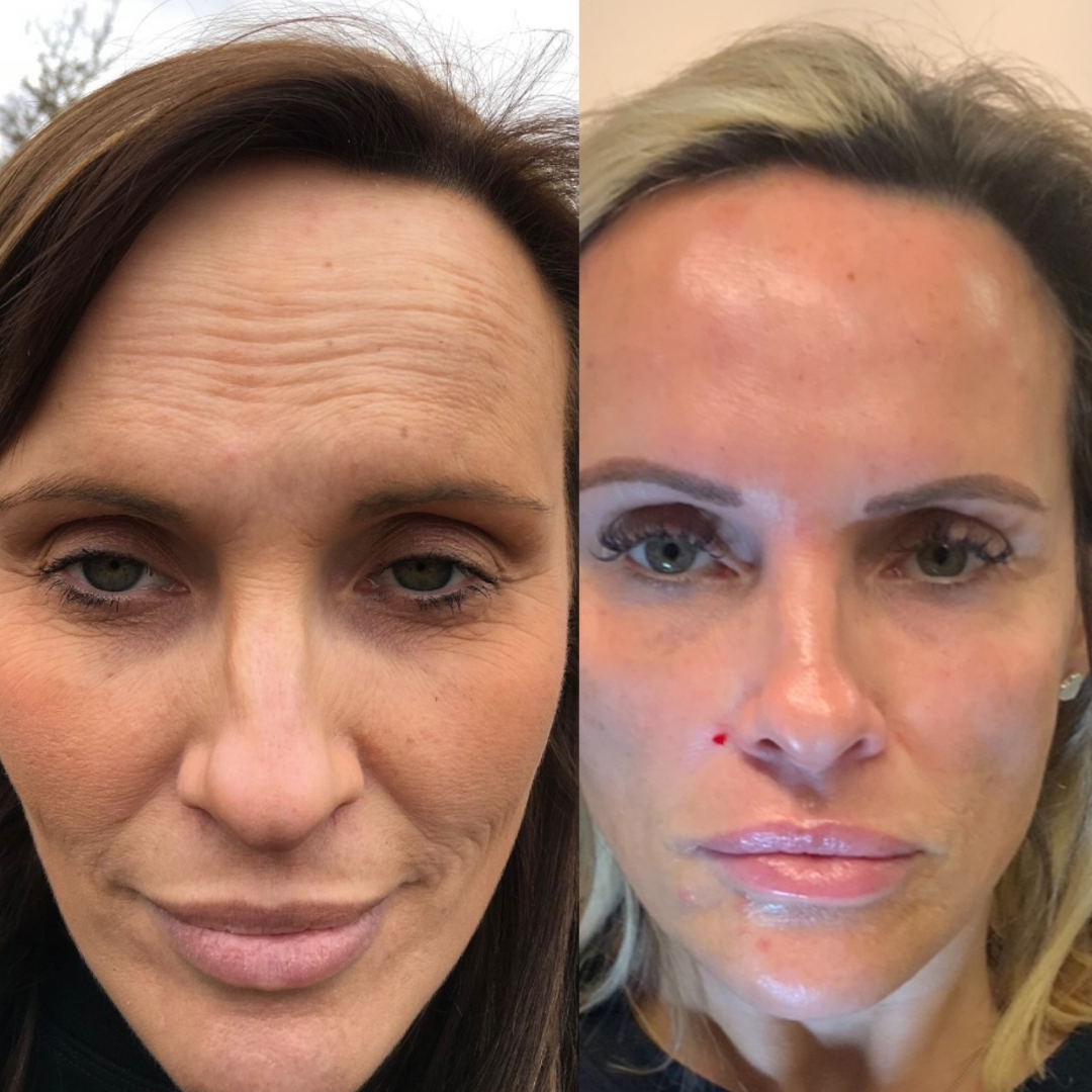 COMPLETE ANTI-AGEING PACKAGE