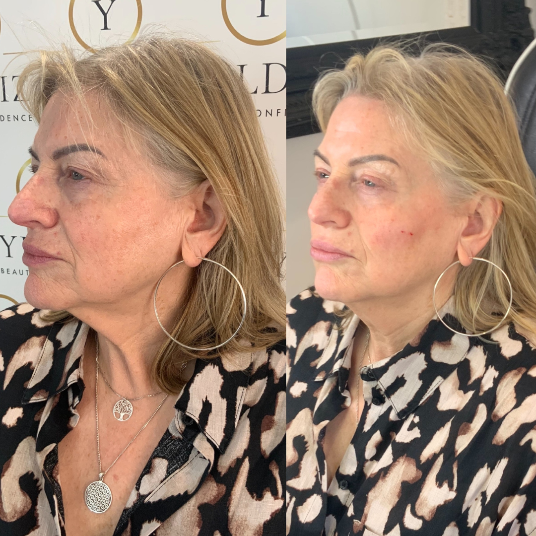 COMPLETE ANTI-AGEING PACKAGE